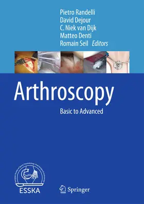 Dejour / Policlinico San Donato / Seil | Arthroscopy | Buch | 978-3-662-49374-8 | sack.de