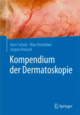 Schulz / Hundeiker / Kreusch |  Kompendium der Dermatoskopie | Buch |  Sack Fachmedien