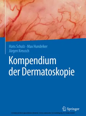 Schulz / Hundeiker / Kreusch |  Kompendium der Dermatoskopie | eBook | Sack Fachmedien