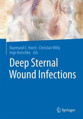 Horch / Kutschka / Willy | Deep Sternal Wound Infections | Buch | 978-3-662-49764-7 | sack.de