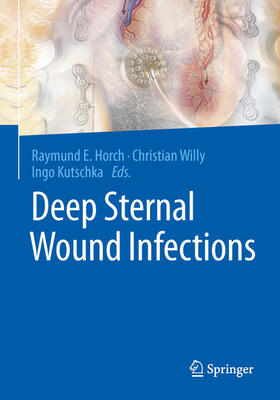 Horch / Willy / Kutschka | Deep Sternal Wound Infections | E-Book | sack.de