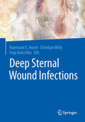 Horch / Willy / Kutschka |  Deep Sternal Wound Infections | eBook | Sack Fachmedien
