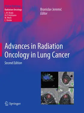 Jeremic |  Advances in Radiation Oncology in Lung Cancer | Buch |  Sack Fachmedien