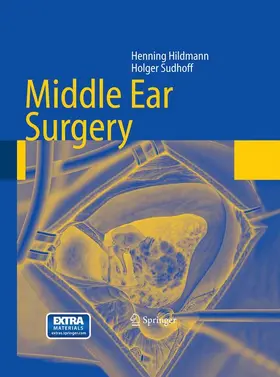 Hildmann / Sudhoff |  Middle Ear Surgery | Buch |  Sack Fachmedien