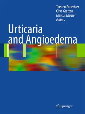 Zuberbier / Grattan / Maurer |  Urticaria and Angioedema | Buch |  Sack Fachmedien
