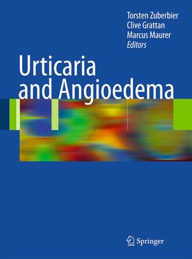 Zuberbier / Maurer / Grattan | Urticaria and Angioedema | Buch | 978-3-662-50092-7 | sack.de