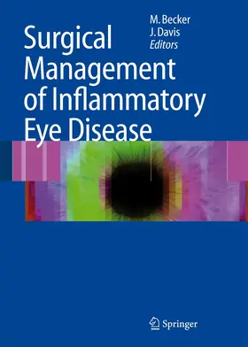 Davis / Becker |  Surgical Management of Inflammatory Eye Disease | Buch |  Sack Fachmedien