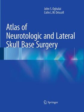 Driscoll / Oghalai | Atlas of Neurotologic and Lateral Skull Base Surgery | Buch | 978-3-662-50139-9 | sack.de