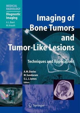 Davies / James / Sundaram |  Imaging of Bone Tumors and Tumor-Like Lesions | Buch |  Sack Fachmedien