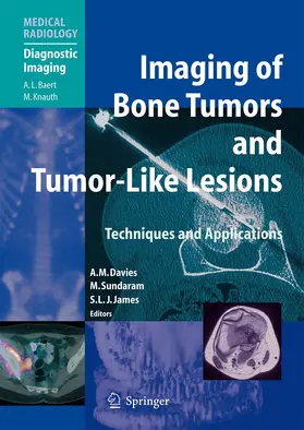 Davies / Sundaram / James |  Imaging of Bone Tumors and Tumor-Like Lesions | Buch |  Sack Fachmedien