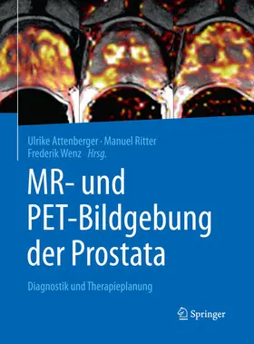 Attenberger / Ritter / Wenz |  MR- und PET-Bildgebung der Prostata | eBook | Sack Fachmedien