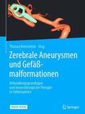Kretschmer |  Zerebrale Aneurysmen und Gefäßmalformationen | Buch |  Sack Fachmedien