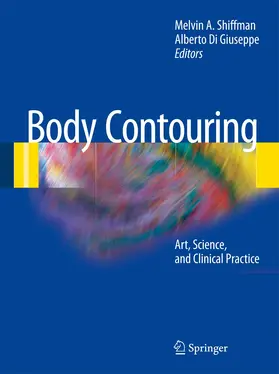 Shiffman / Di Giuseppe |  Body Contouring | Buch |  Sack Fachmedien