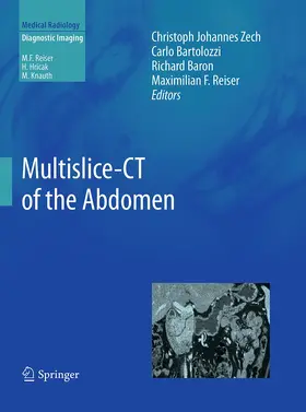 Zech / Bartolozzi / Baron |  Multislice-CT of the Abdomen | Buch |  Sack Fachmedien