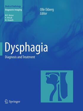 Ekberg |  Dysphagia | Buch |  Sack Fachmedien