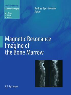 Baur-Melnyk |  Magnetic Resonance Imaging of the Bone Marrow | Buch |  Sack Fachmedien
