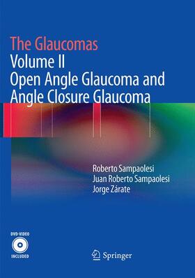 Sampaolesi / Zárate | The Glaucomas | Buch | 978-3-662-50758-2 | sack.de