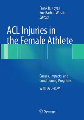 Barber-Westin / Noyes |  ACL Injuries in the Female Athlete | Buch |  Sack Fachmedien