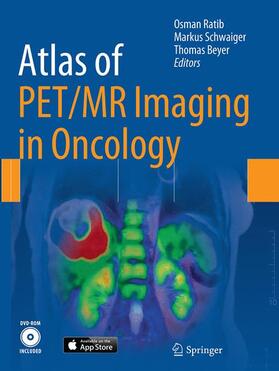 Ratib / Beyer / Schwaiger | Atlas of PET/MR Imaging in Oncology | Buch | 978-3-662-50995-1 | sack.de