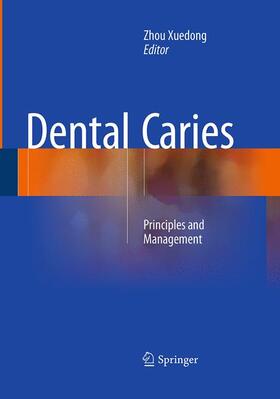 Xuedong | Dental Caries | Buch | 978-3-662-51045-2 | sack.de