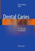 Xuedong |  Dental Caries | Buch |  Sack Fachmedien