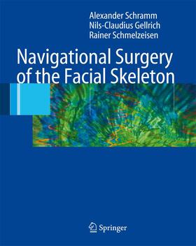 Schramm / Schmelzeisen / Gellrich |  Navigational Surgery of the Facial Skeleton | Buch |  Sack Fachmedien