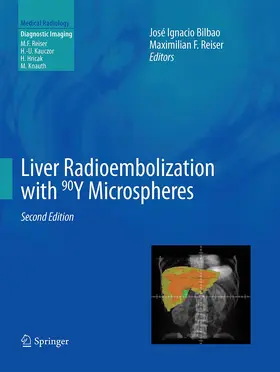Reiser / Bilbao | Liver Radioembolization with 90Y Microspheres | Buch | 978-3-662-51818-2 | www.sack.de