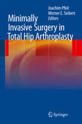 Siebert / Pfeil |  Minimally Invasive Surgery in Total Hip Arthroplasty | Buch |  Sack Fachmedien