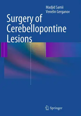 Samii / Gerganov |  Surgery of Cerebellopontine Lesions | Buch |  Sack Fachmedien