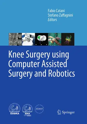 Catani / Zaffagnini | Knee Surgery using Computer Assisted Surgery and Robotics | Buch | 978-3-662-52131-1 | www.sack.de