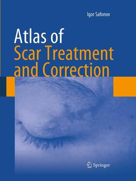 Safonov | Atlas of Scar Treatment and Correction | Buch | 978-3-662-52165-6 | sack.de