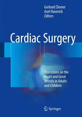 Haverich / Ziemer |  Cardiac Surgery | Buch |  Sack Fachmedien