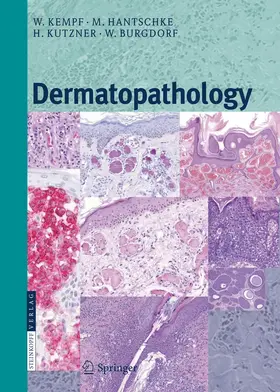 Kempf / Hantschke / Kutzner |  Dermatopathology | Buch |  Sack Fachmedien