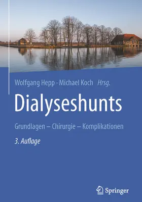 Hepp / Koch |  Dialyseshunts | eBook | Sack Fachmedien