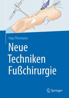 Thermann | Neue Techniken Fußchirurgie | Buch | 978-3-662-52736-8 | sack.de