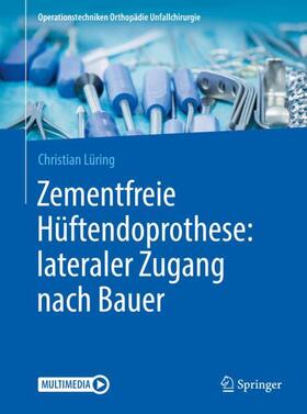 Lüring | Zementfreie Hüftendoprothese: lateraler Zugang nach Bauer | Buch | 978-3-662-53296-6 | sack.de