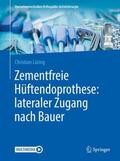 Lüring |  Zementfreie Hüftendoprothese: lateraler Zugang nach Bauer | Buch |  Sack Fachmedien