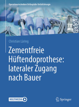 Lüring | Zementfreie Hüftendoprothese: lateraler Zugang nach Bauer | E-Book | sack.de