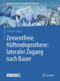 Lüring |  Zementfreie Hüftendoprothese: lateraler Zugang nach Bauer | eBook | Sack Fachmedien
