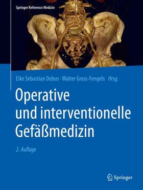 Debus / Gross-Fengels |  Operative und interventionelle Gefäßmedizin | Buch |  Sack Fachmedien