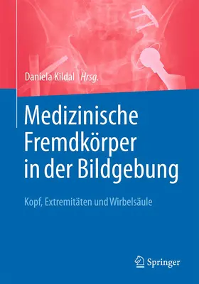 Kildal |  Medizinische Fremdkörper in der Bildgebung | Buch |  Sack Fachmedien