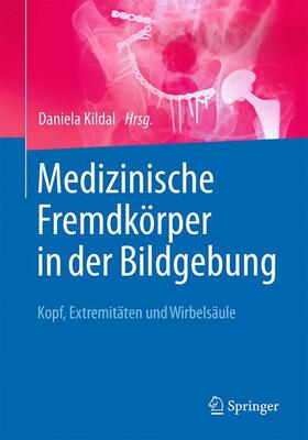 Kildal | Medizinische Fremdkörper in der Bildgebung | Buch | 978-3-662-53749-7 | sack.de