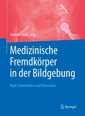 Kildal | Medizinische Fremdkörper in der Bildgebung | E-Book | www.sack.de