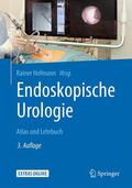 Hofmann |  Endoskopische Urologie | Buch |  Sack Fachmedien