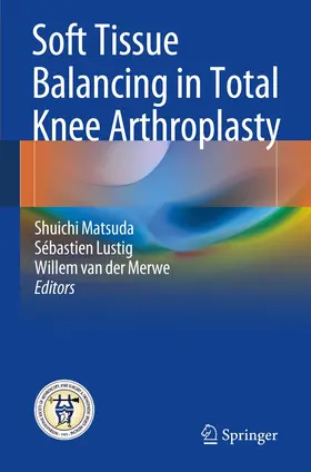 Matsuda / Lustig / van der Merwe | Soft Tissue Balancing in Total Knee Arthroplasty | Buch | 978-3-662-54081-7 | www.sack.de