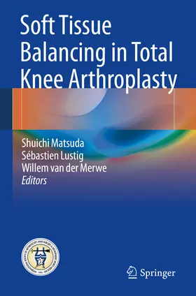Matsuda / Lustig / van der Merwe |  Soft Tissue Balancing in Total Knee Arthroplasty | eBook | Sack Fachmedien
