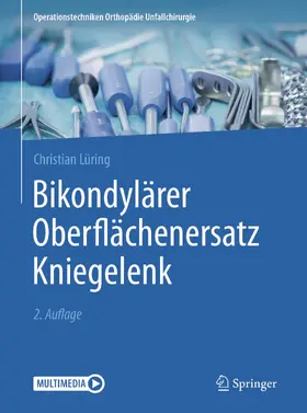 Lüring | Bikondylärer Oberflächenersatz Kniegelenk | E-Book | www.sack.de