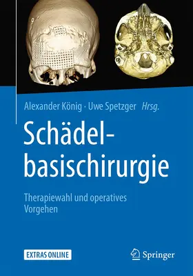 König / Spetzger |  Schädelbasischirurgie | Buch |  Sack Fachmedien