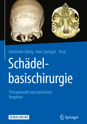 König / Spetzger |  Schädelbasischirurgie | eBook | Sack Fachmedien