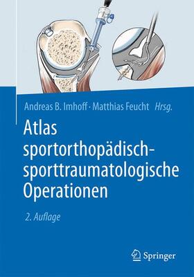 Feucht / Imhoff | Atlas sportorthopädisch-sporttraumatologische Operationen | Buch | 978-3-662-54834-9 | sack.de
